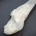 a-sharp-stone-tool-cut-this-early-human39s-jaw-100000-years-ago-but-the-healed-bone-shows-he-survive.avif