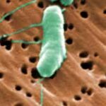 florida39s-first-flesh-eating-bacteria-death-of-2026.jpg