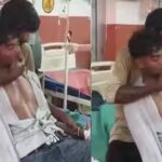 hardoi-man-slapped-150-times-after-snake-bite.jpg