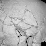 the-14th-century-warriors-skull-was-broken-in-61-places-university-of-bradford-photo.jpg