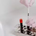 blood-test.jpg