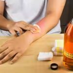 removing-mole-with-apple-cider-vinegar.jpg