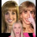 cosmetic-doctor-reacts-to-susan-dells-before-and-after-photos.jpg