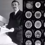 godfrey-hounsfield-stands-beside-the-emi-scanner-in-1972-and-modern-ct-scans-provide-much-higher-res.avif