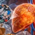researchers-found-that-polyethylene-microplastics-worsened-signs-of-fatty-liver-especially-when-comb.avif